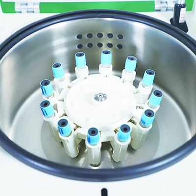 HLA検査と赤血球浄化洗濯機 遠心分離機 ISO認証