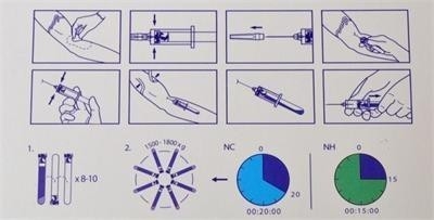 6/8x15ml ポータブルPRP遠心分離装置 0-4000rpm 整形外科病院用